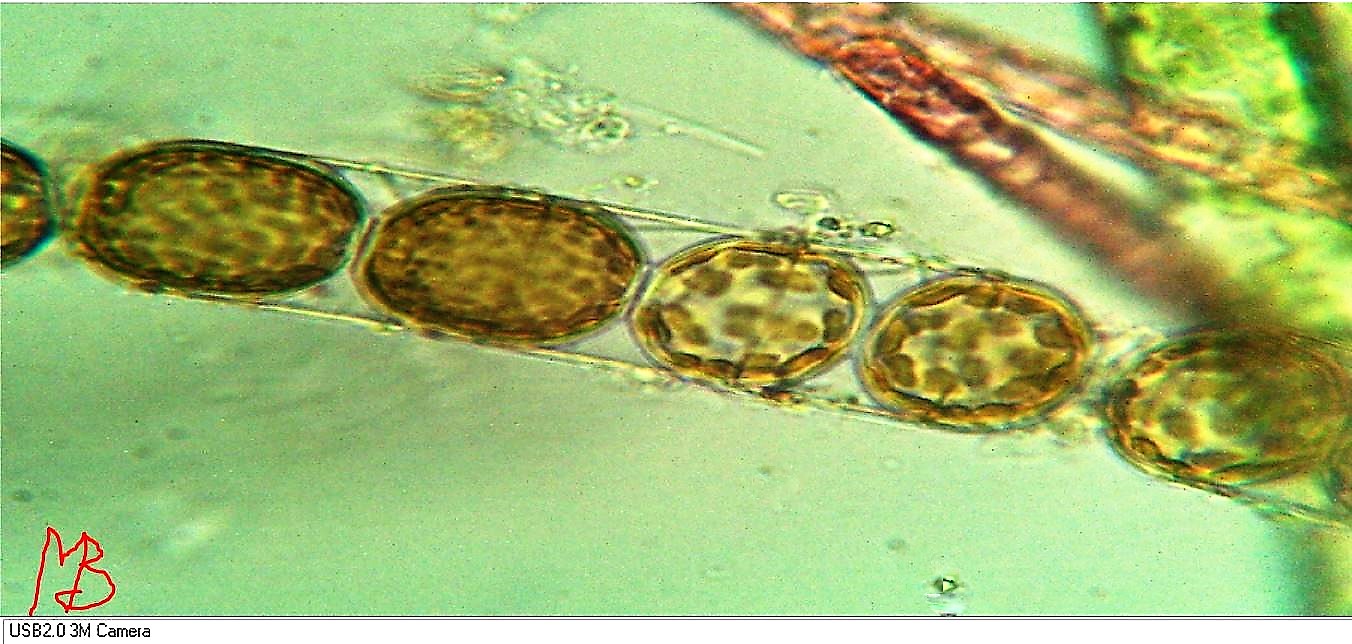 Diatomea Melosira nummuloides